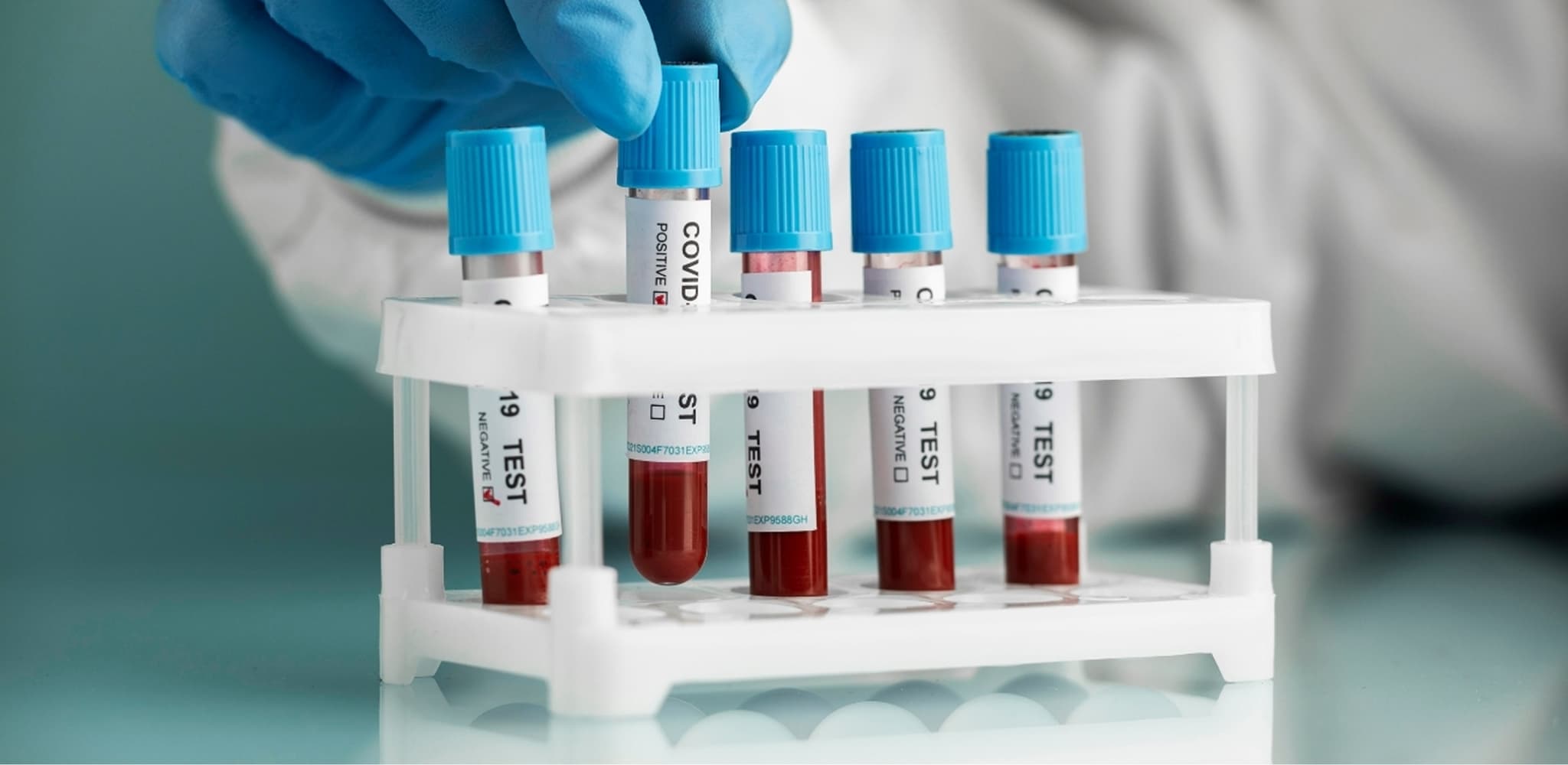  COVID-19 Testing - PCR & Rapid Tests