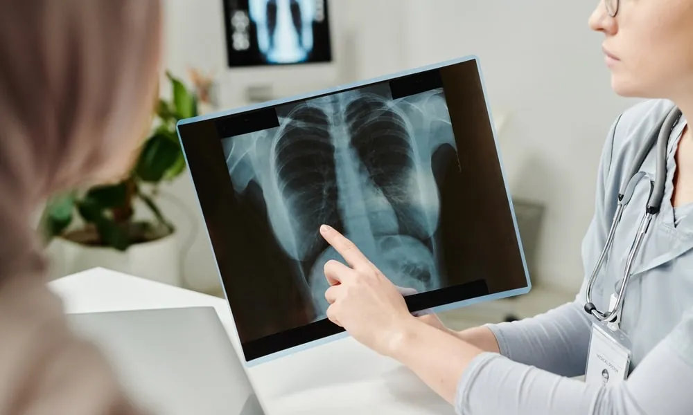 X-Rays at Mederi Urgent Care